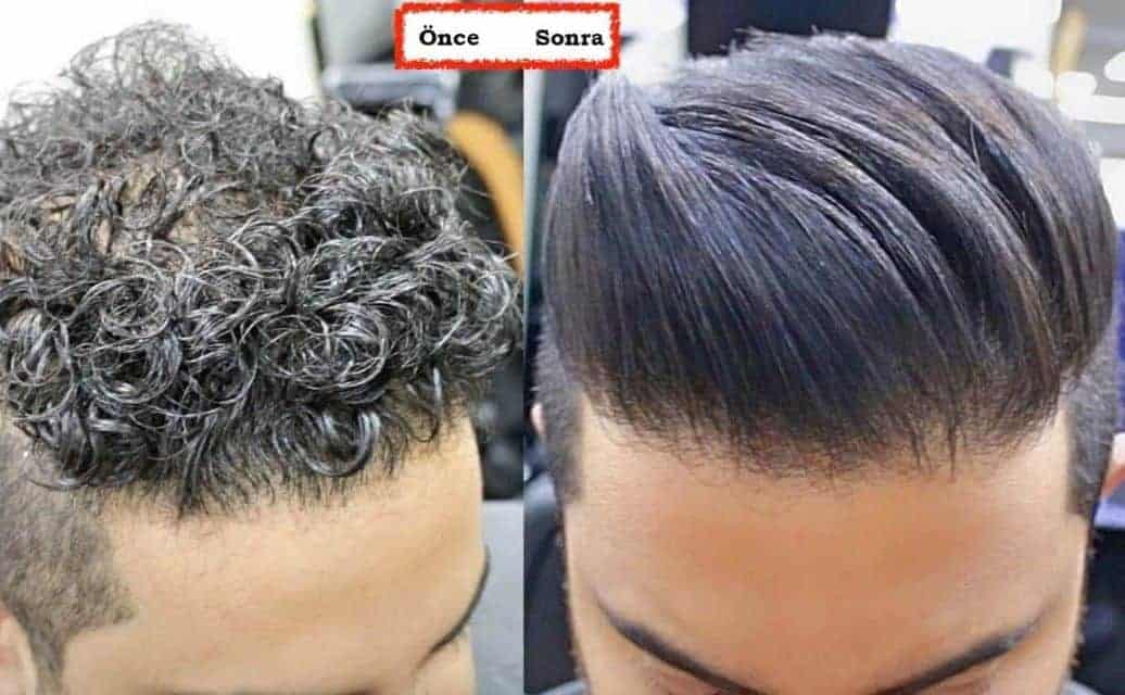 Adana Erkek Keratin